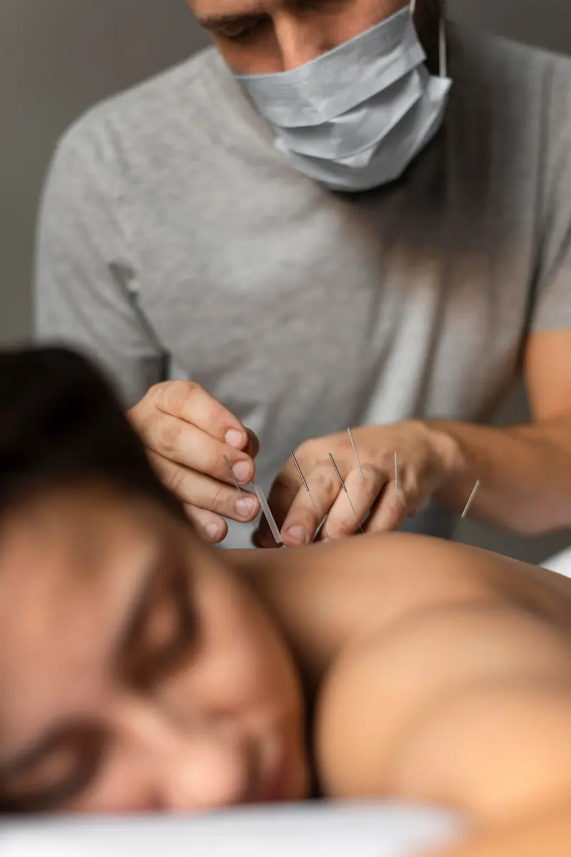 Fisioterapeuta aplicando dry needling